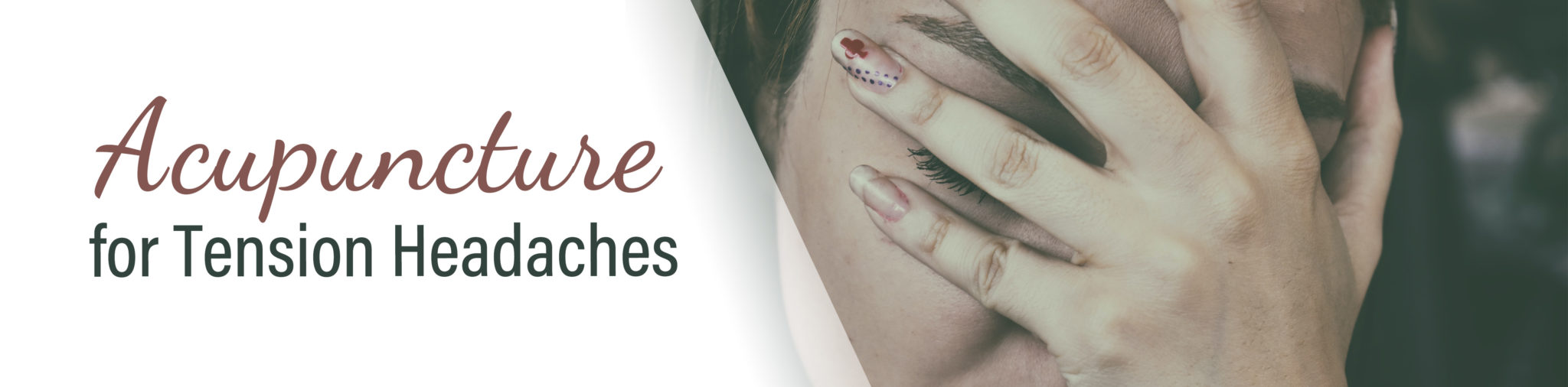 Acupuncture for Tension Headaches » Professional Acupuncture & Physical